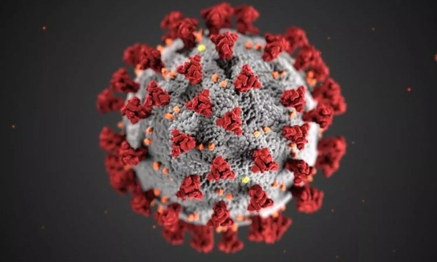 Global Covid-19 caseload tops 157.2 mn