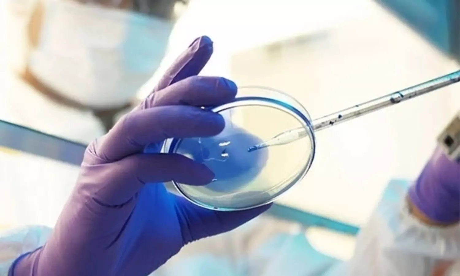 Northeast reports first death due to mucormycosis