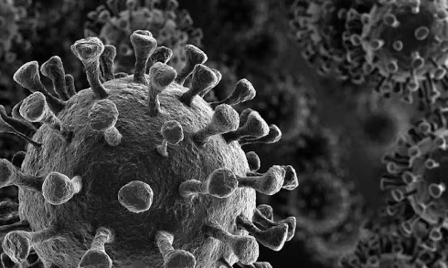 Black fungus found in brains of many patients in Indore hospital