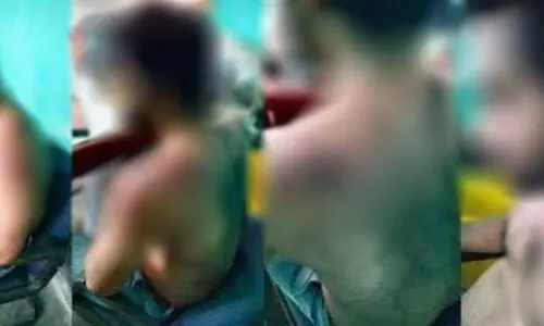 Physician sustains serious injury in attack of irate mob in Hojai dist