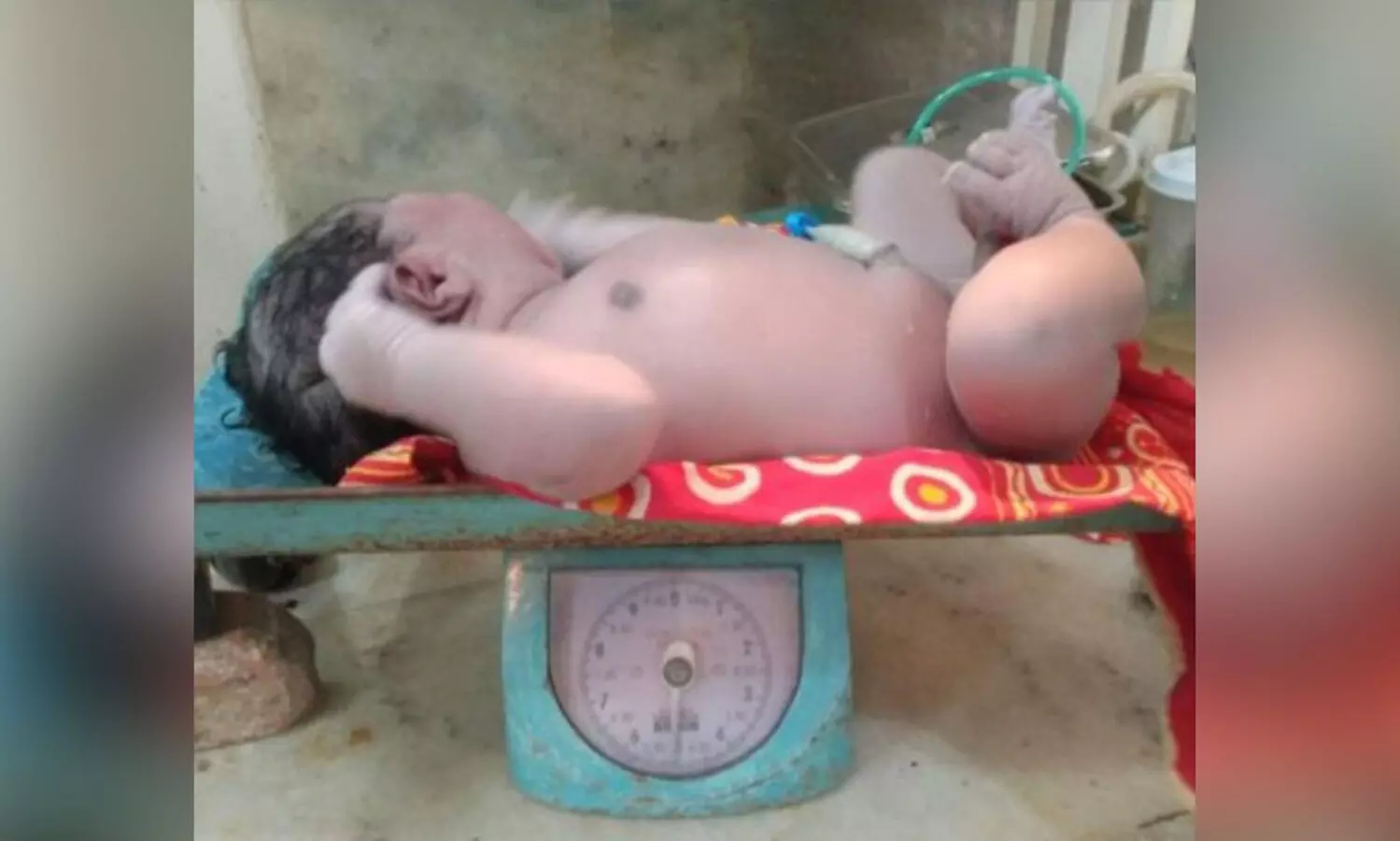 Woman in Silchar gives birth to heaviest child in Assam