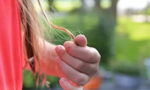 Does using oil on your hair cause hair loss?