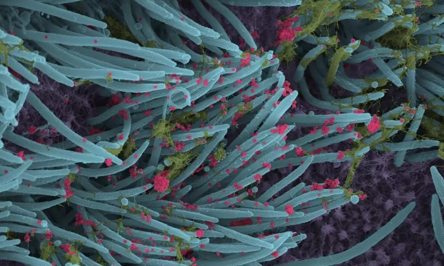 Understanding how bats resist Covid can aid new treatments in humans