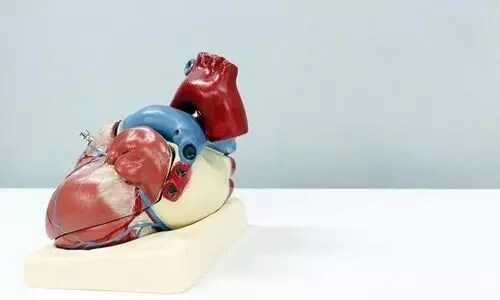 Myth or Fact: Exercise must be avoided after a heart attack