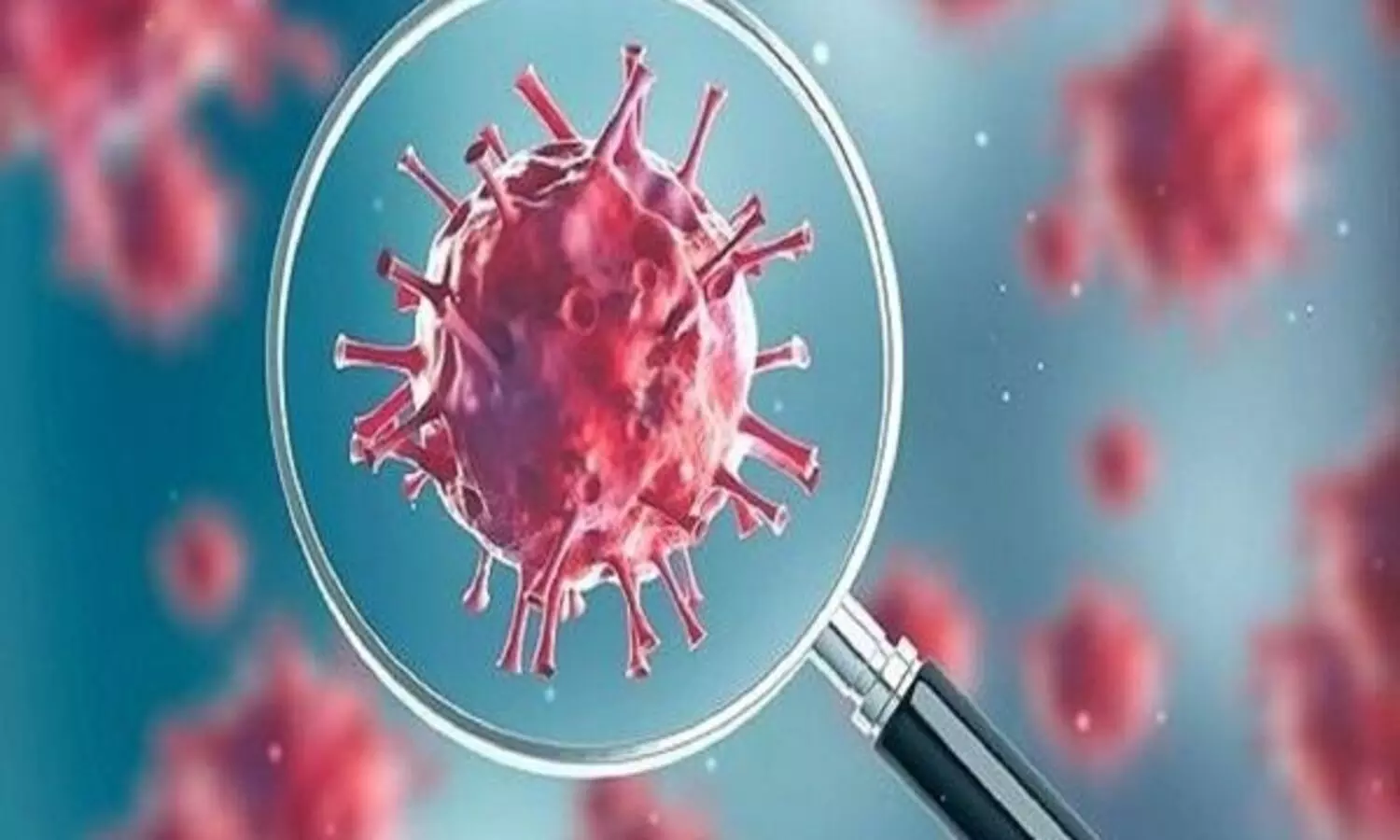 Global Covid-19 caseload tops 231.4 million