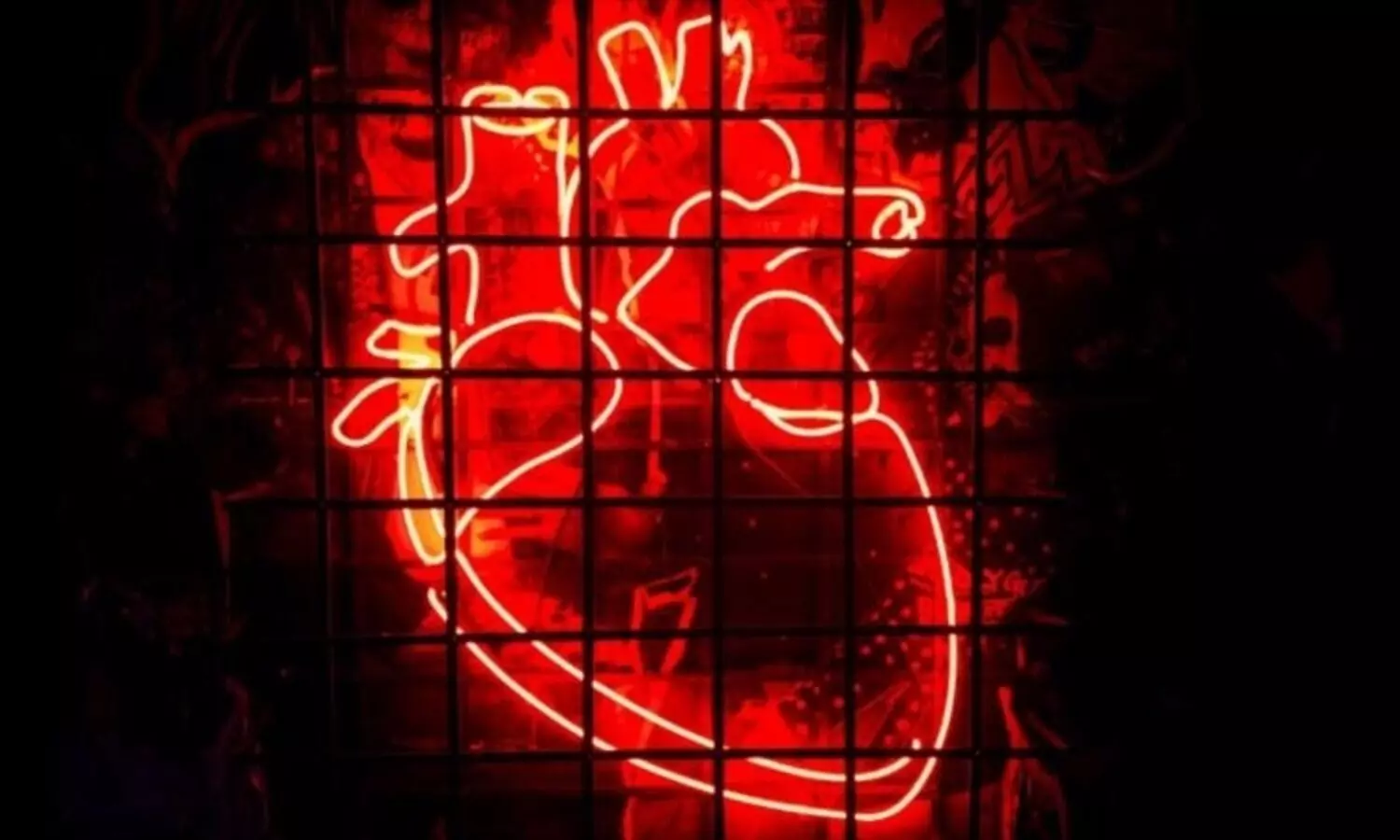 Women can have a heart problem & not even realise it