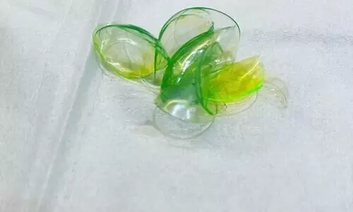 Viral: Doctor removes 23 contact lenses from womans eye