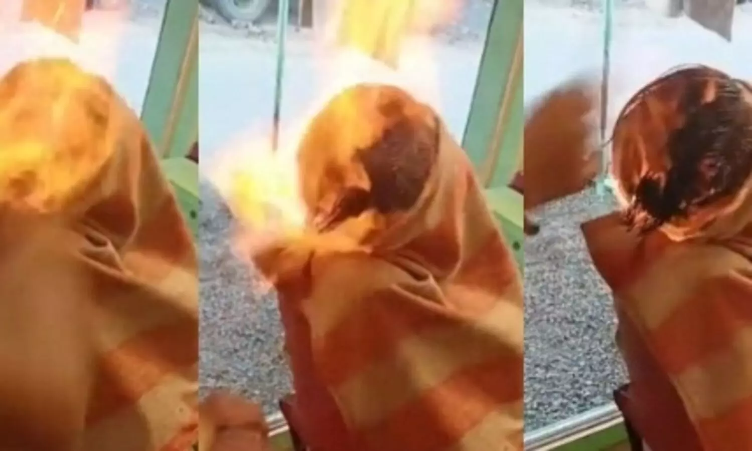 Gujarat youth suffers burn injuries after fire hair cut goes wrong