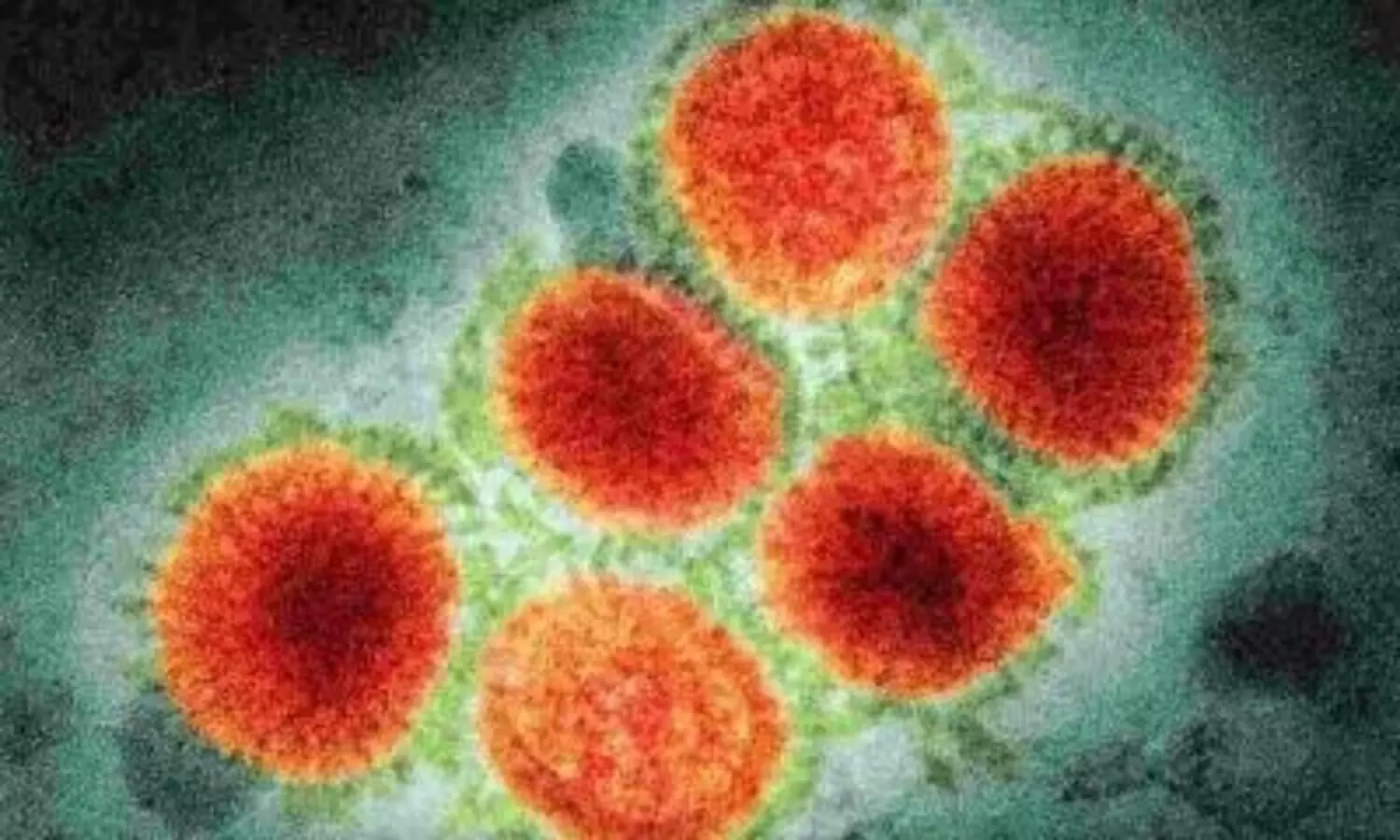 WHO reports first death from H3N8 virus in China