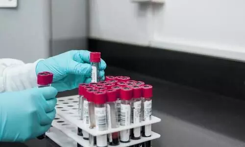 Indian startup develops AI-based blood test to detect 32 cancers early
