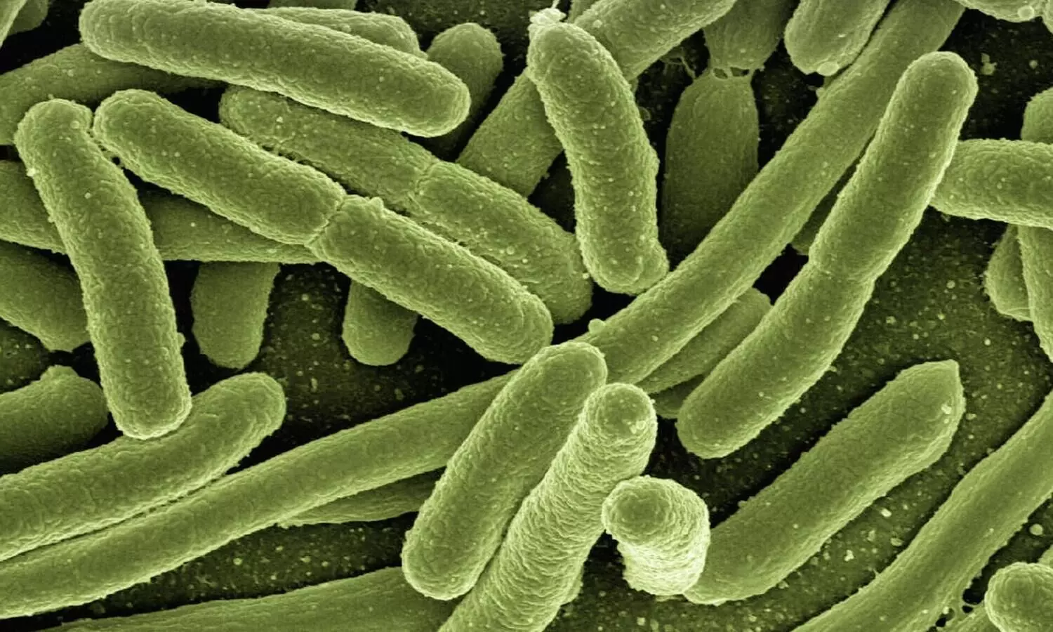 Climate change increasing risk of new emerging viruses, infectious diseases in India: experts