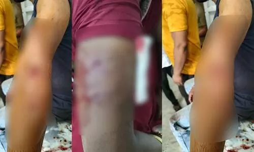 Guwahati: Leopard attacks two people in Fatasil Ambari