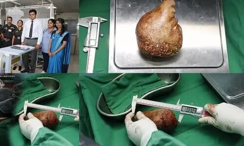 SL Army doctors set Guinness Record after removing worlds largest & heaviest kidney stone