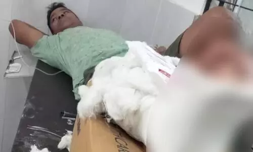 Man held for extorting money hurt in police firing: Officials