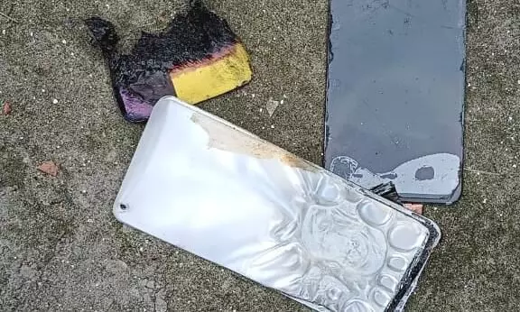 Assam: Mobile phone explosion injures one in Barpeta Assam: Mobile phone explosion injures one in Barpeta