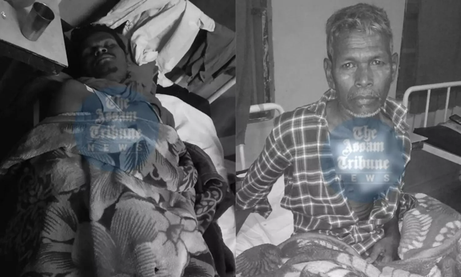 Assam: Father-son duo critically injured in leopard attack