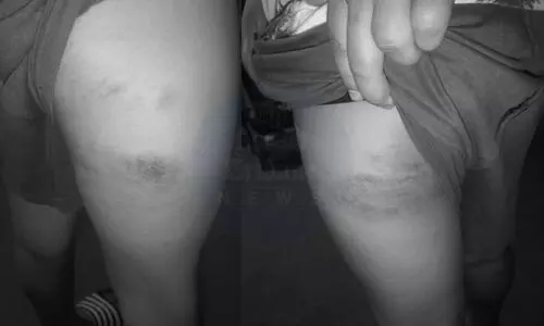 Ragging incident at Arunachal Pradesh school sparks outrage