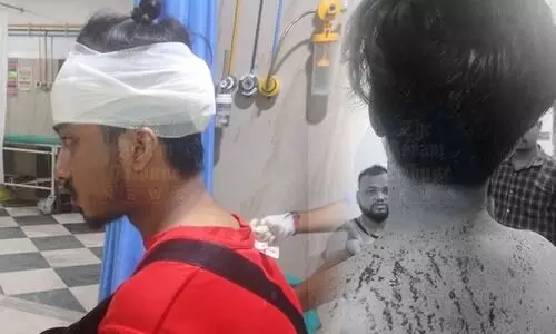 Assamese musician files FIR against former roommate after assault in Rukminigaon