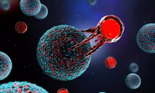 Representational Image