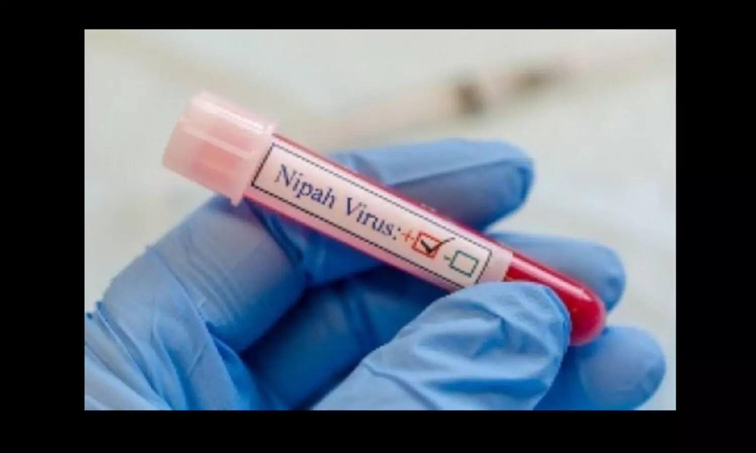 Kerala woman tests positive for Nipah Photo: IANS