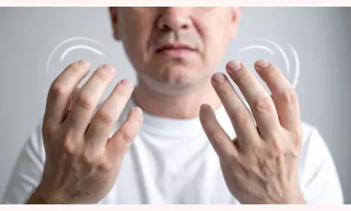 Representational Image