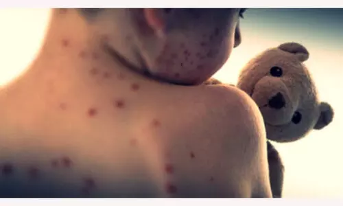 Representational Image