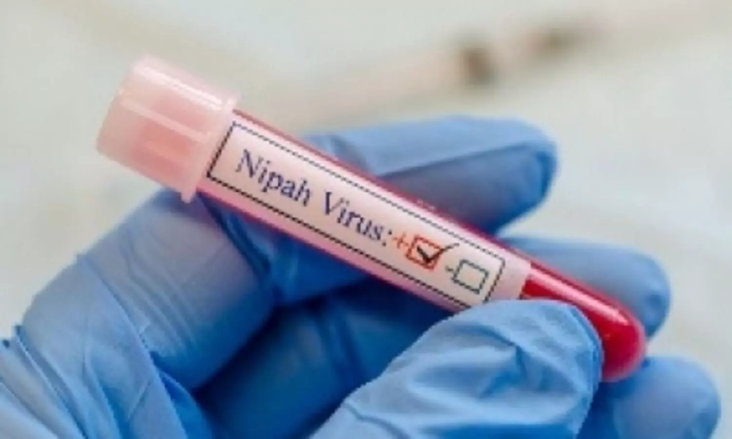 After man dies of Nipah virus, six Kerala districts put on alert Representational Image