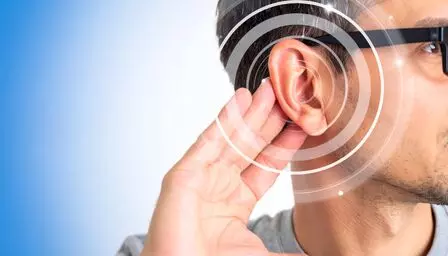 Representational Image Representational Image