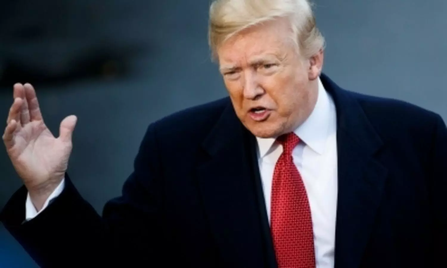 Explained: What is chronic venous insufficiency that Donald Trump is suffering from Explained: What is chronic venous insufficiency that Donald Trump is suffering from