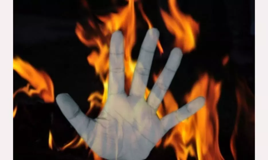 Representational Image Representational Image