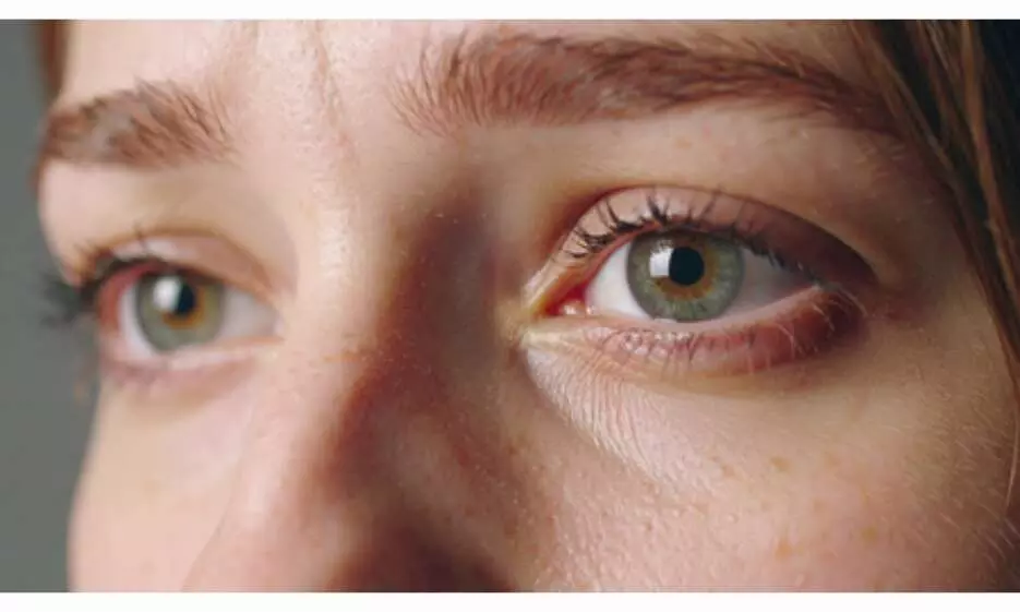 Representational Image