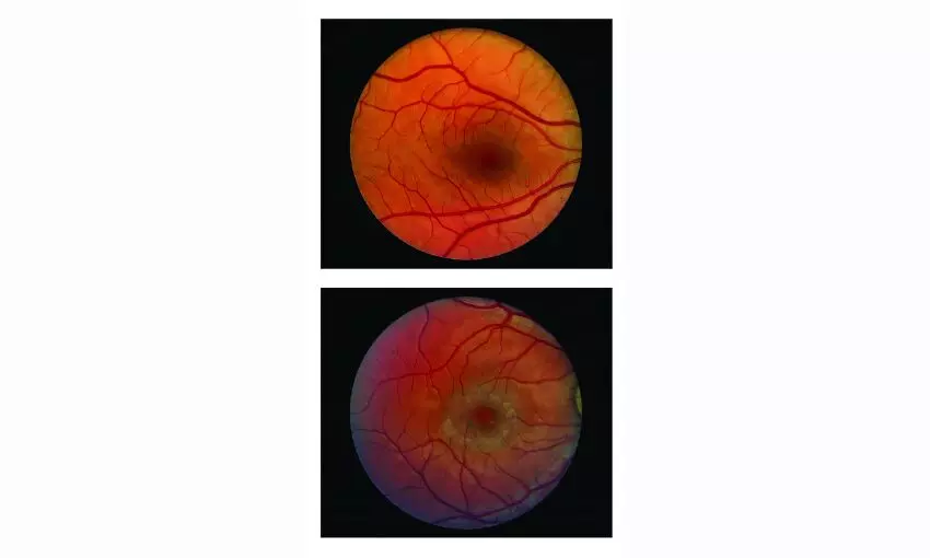 Representational Image