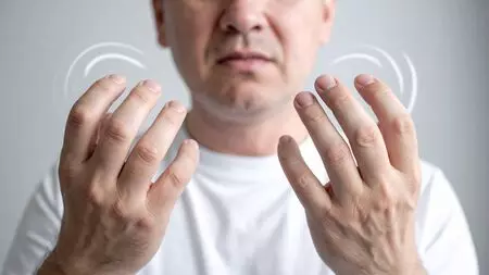 Representational Image