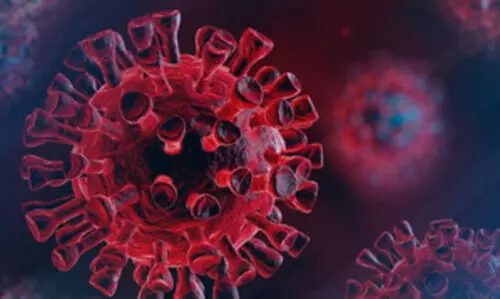 Representational Image