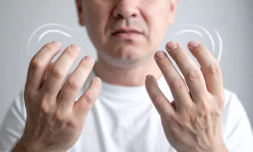 Representational Image