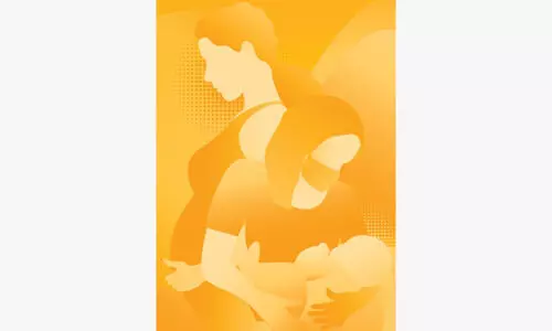 Representational Image