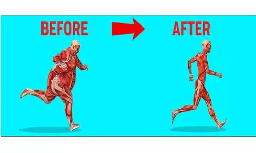 Representational Image