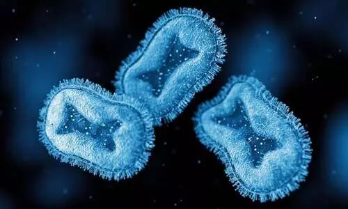 Representational Image