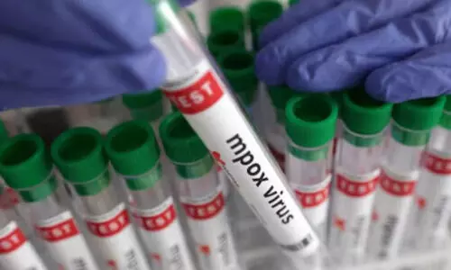 Representational Image