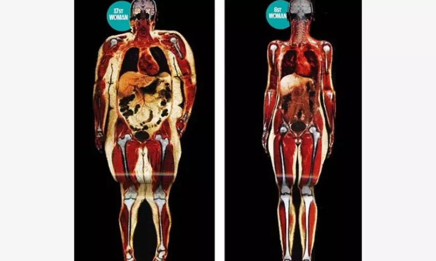 Representational Image