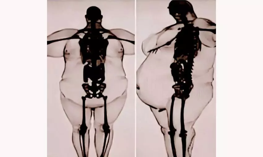 Representational Image