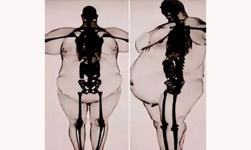 Representational Image