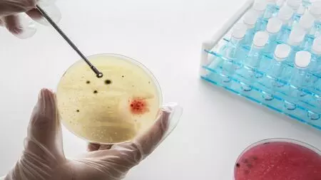 Study finds targeted steroid use may be effective against TB