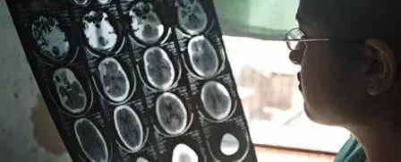 Brain disorders impact 1 in 3 globally, causing 11 million deaths annually: Study