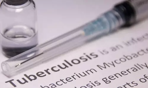 Philippines ramps up TB control efforts, targets 12 million screenings by 2026