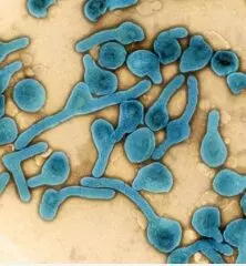 Marburg threat: South Sudan heightens surveillance, border checks