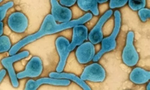 Marburg threat: South Sudan heightens surveillance, border checks