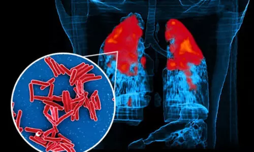 IIT Bombay study reveals how TB bacteria shield themselves from antibiotics