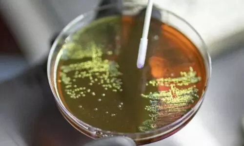 Antimicrobial resistance: A present-day challenge the world can’t ignore