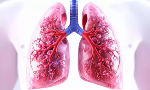 New blood test can detect and track lung cancer progression in real time